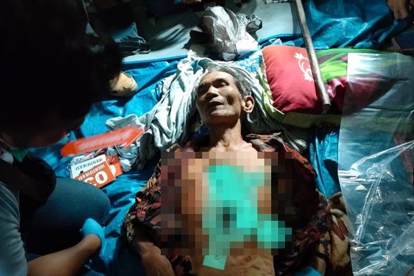 Brutal!  Pulang Pesta, Lansia di Nias Selatan Tewas Ditombak