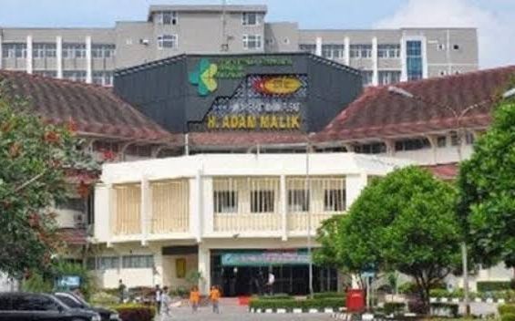 Bayi Kembar Siam Hasan dan Husin di RSUP HAM Meninggal Dunia