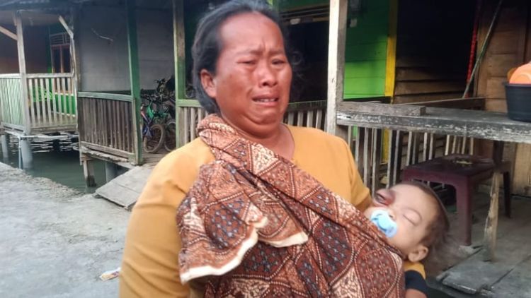 Balita di Batubara Butuh Uluran Tangan Untuk Biaya Operasi