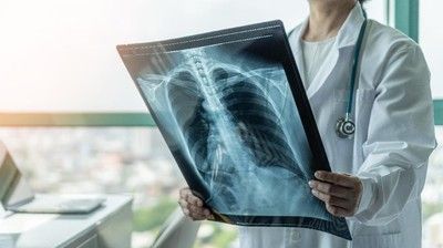 3 Jenis Olahraga Ini Dianjurkan untuk Penderita Asma