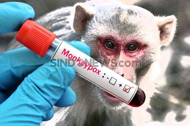7 Fakta Cacar Monyet yang Perlu Diperhatikan