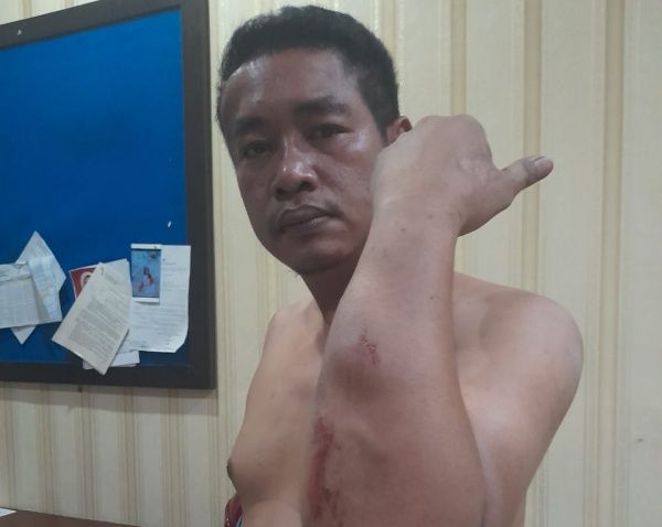 Duh, Wartawan Media Online di Labuhanbatu Dianiaya Sejumlah OTK Bermasker