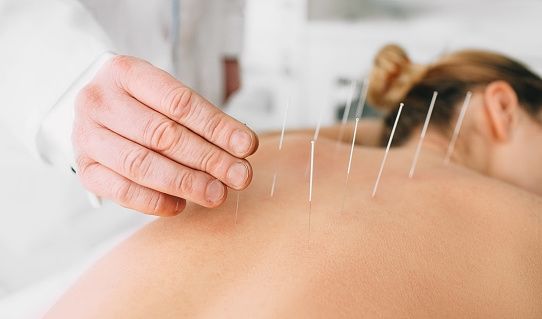 Benarkah Akupuntur Bisa Bantu Atasi Masalah Obesitas, Begini Kata Pakar