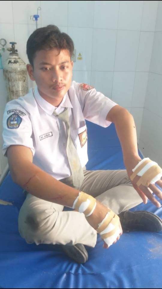 Geger! Pelajar Sergai Dibacoki Sekelompok Orang, Pelaku Masih Diburu Polisi