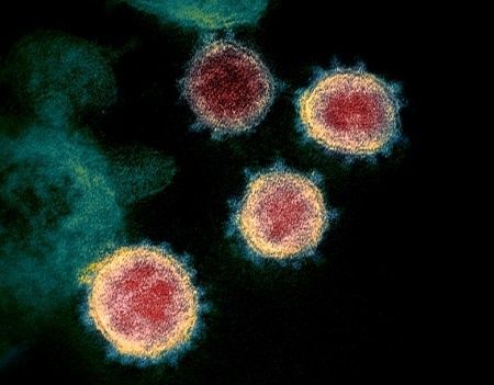 Virus Zombie Berusia 50 Ribu Tahun Dihidupkan Kembali