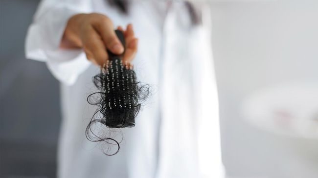 Bikin Rambut Tiba-tiba Rontok, Apa Itu Alopecia Areata?